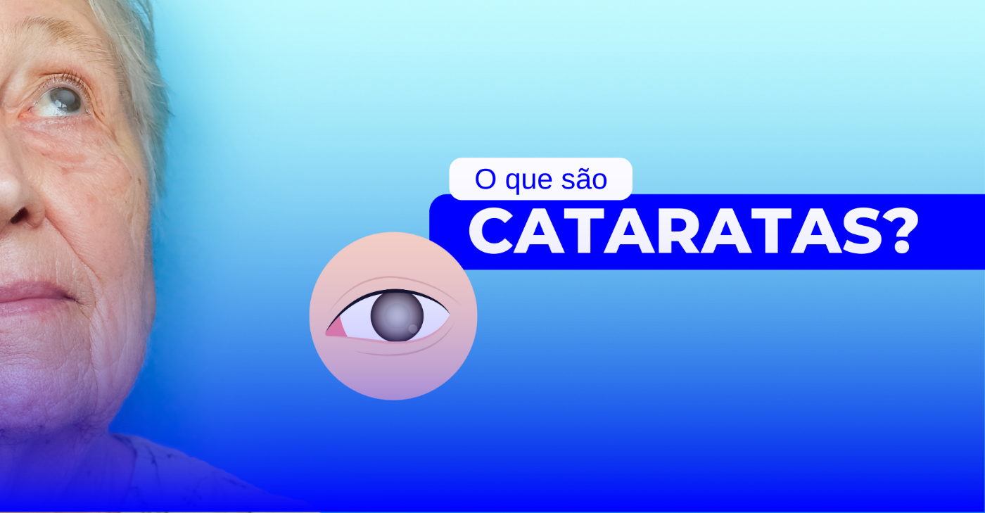 O que são Cataratas?